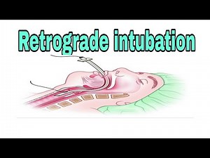 Retrograde intubation, its indication and contra indication @anaesthesiawithbabar2576