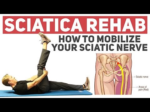 Nerve Mobilizations for Sciatica