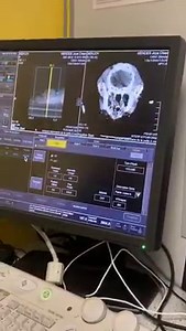 Deuxième étape du scanner : injecter un produit de contraste 🙏 Prenez rendez-vous sur : 👉 www.parisouestveto ☎️ 01.39.31.62.62 🏩 155 Bd Victor Bordier, 95370 Montigny-lès-Cormeilles 👉 Clinique Vétérinaire De La Patte D'oie | Sevetys