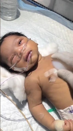 The baby can maintain stable oxygen levels and breathe without the help of a ventilator, CPAP,#nicu