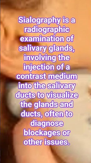 What is Sialography ? #sialography