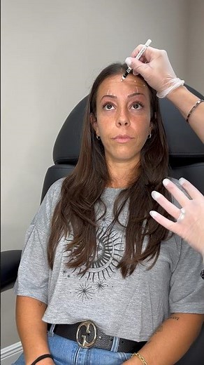 Botox, 101 mapping and injecting neurotoxins ￼