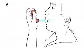 Step-by-Step: Using an Inhaler: Open Mouth