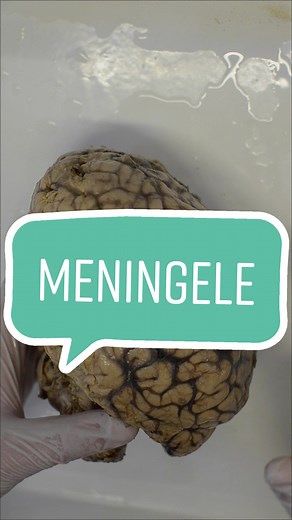 ig:bioclass.ro #bioclass #medicine #disecție #anatomie #anatomy #dissection #dissectionlab #dissectionclub