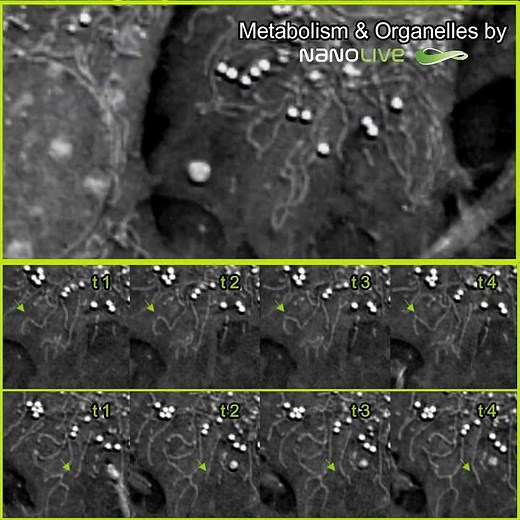 Real-time mitochondrial dynamics with Nanolive