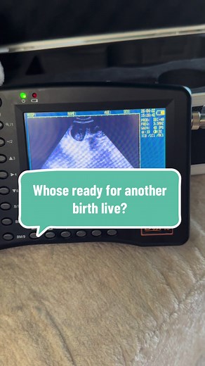 Zelalin Haremi birth livestream in 30 days — who's ready?