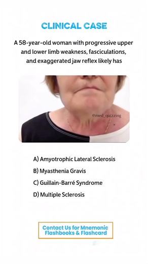 𝑴𝒆𝒅 𝑸𝒖𝒊𝒛𝒛𝒊𝒏𝒈 on Instagram: "Comment “Details” and check your inbox for the full mnemonic flashbook & flashcards! 📕✨ . . . . . . #medical #medicine #medicalstudent #medicinestudent #usmle #step1 #plab #mrcp #medicine #reels #viral #foryou #anatomy #reelexplore #instagram #neurology #nephrology #surgery #students #colleges #cardiology #knowledge #virals #plab #UK #USA #newyork #nyc #neet"