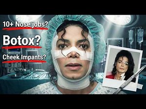 You Won’t Believe How Much Plastic Surgery Michael Jackson Actually Had – Before & After