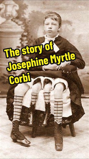 Josephine Myrtle Corbin: The Woman with Four Legs