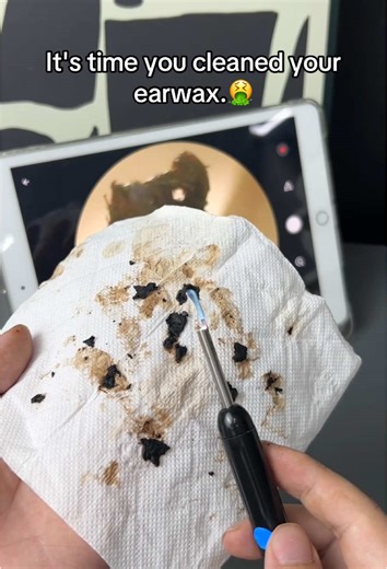 Earwax Removal Tool Review: Satisfying Clean for $5