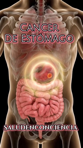 10K views · 366 reactions | En este video, el Dr. Andreas Kalcker,...