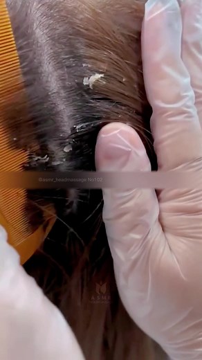 ASMR Headmassage.No102#asmr #asmrcommunity #relievestress #headmassage #hairspa #asmrsounds #relievinganxietr #relax #sleep #Wash #relievestresr