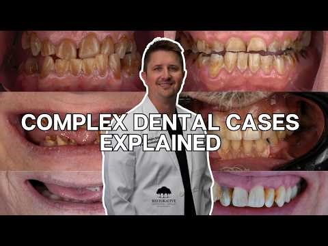 Complex Dental Cases Explained by a Prosthodontist