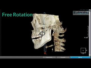 How to: Navigating on OnDemand3D