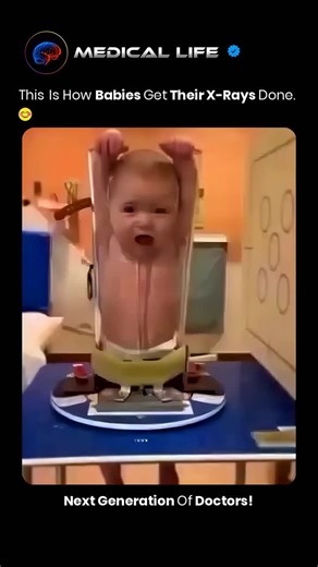 DR. kavya on Instagram: "Ever wondered how babies get their X-rays done? It's a fascinating process! When a baby needs an X-ray, they're gently placed on a special table ️ and positioned to get the best possible image . The X-ray machine then uses low doses of radiation to capture images of their tiny bones and organs . The whole process is quick, safe, and painless , and helps doctors diagnose and treat any potential health issues . It's amazing how medical technology can help us care for our l