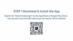 ScopeAround SA39W Wireless Otoscope Quick Start Guide: Setup, App Connection & Ear Examination
