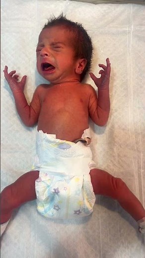 Baby Crying 😭 | Real NICU Moments.That tiny cry says everything 😭Real emotions, real NICU moments