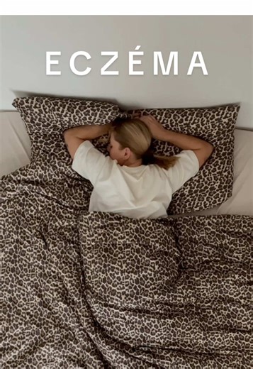 Ça, c’était mes nuits avant @A-derma 🌙 - publicité - J’ai de l’eczéma sur les mains depuis que j’ai 15 ans. Petite, j’en avais même sur les orteils.. ça me grattait tellement que je me frottais jusqu’au sang sur les draps pendant la nuit.. Et s’il y a bien un moment où l’eczéma est le plus dur à vivre, c’est le soir, quand les démangeaisons se réveillent et t’empêchent complètement de dormir.. Alors depuis peu, j’ai intégré Exomega Night Control de chez A-DERMA dans ma routine du soir et résult