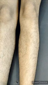 Full Leg Waxing With Aloe Vera wax | how to do full leg waxing (part 1) #legswaxing #legwax #beauty #facebookpost #facebook #viralpost #viral #post #facebookpost | Armpit Wax