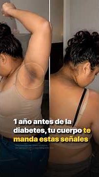 1 Year Before Diabetes, Your Body Sends These Signs