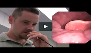 High resolution Nasoendoscopy by Bill Kinkle (at Paul Baker's course in Auckland NZ)