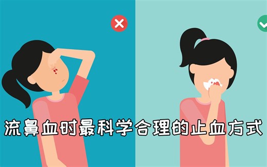 流鼻血时最科学合理的止血方式