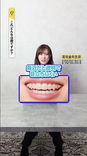 八重歯の症例解説！ #女医 #歯科 #歯医者 #歯科医師 #矯正
