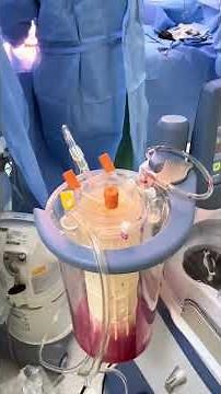 ⏰🫀 A DAY IN THE LIFE OF A BIOMEDICAL PERFUSIONIST Inside the Surgical Center