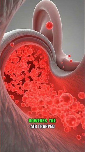 Why Your Ears Pop on Planes? ✈️👂