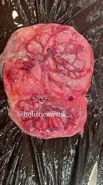 Placenta Encapsulation #mamamystik #secretskeptinnature