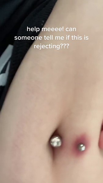 Dealing with Belly Button Piercing Rejection: What to Watch Out For