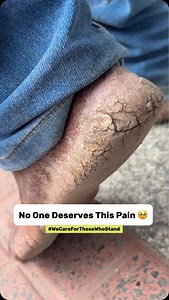 Vilvah Store | Skin & Haircare | Neenga kashtapattu uzhaikringa, Unga feet kashtapadama irukatume! 👣 Every step tells a story of endurance! Let our Foot Cream repair,... | Instagram