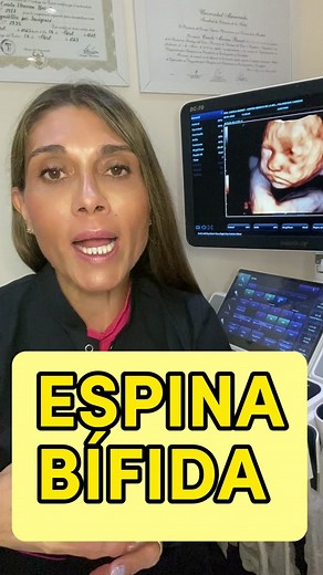 ¿Qué es la espina bífida? Malformación del tubo neural