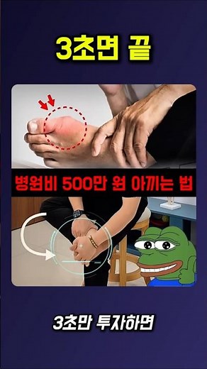 3초 엄지발가락 회전 #발가락통증 #발가락스트레칭
