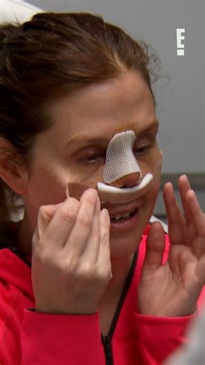 Botched on Instagram: "Me after taking all the credit for a group project I did no work for 😅 #Botched"