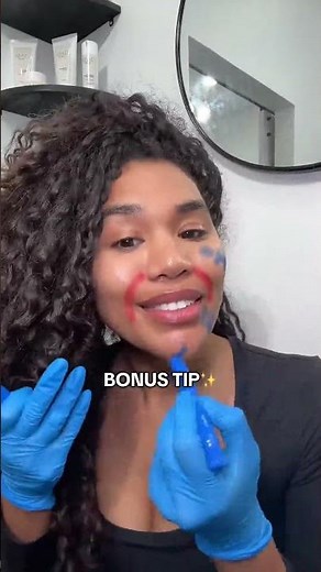 Smile line filler is only HALF the fix! Try these placements to maximize results with lines and