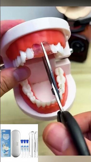 this moldable tooth repair kit is a game-changer for fixing gaps, missing teeth, or chips