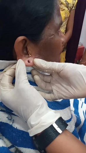 Professional Ear Piercing Process Explained
