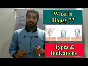 What is Biopsy ? Indication and types of biopsy