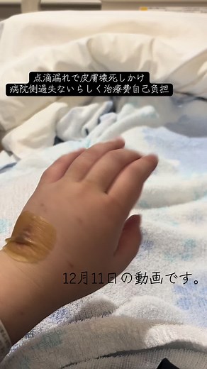 帝王切開後の医療トラブルと痛み