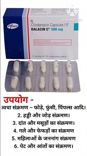 Clindamycin 300 mg how to use..