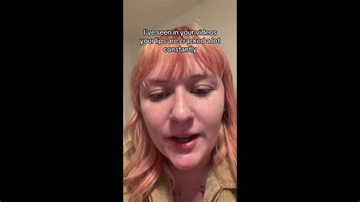 TikTok creator’s “fungus face” reveal goes viral after stranger solves her lip mystery