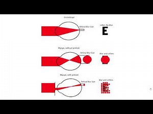 Depth of Focus for Subjective Refraction