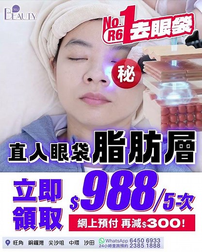 眼袋真係無得救？R6去眼袋療程【免費體驗】🔥一次見效🔥針對 | 眼袋 | 淚溝凹陷 | 眼周鬆弛 | 黑眼圈顯老