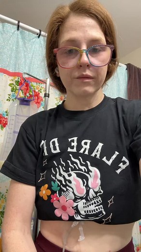 16 reactions · 3 comments | Administering the polyethylene glycol to help manage the side effects of the pain medications. Cramping always. I never had issues with flushes causing pain before either until the last 3 weeks. I don’t get it. #tubie #gastroparesis #dysautonomia #chronicillness #tubefed #pots #dietitian | Stephanie Eddy | Facebook