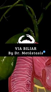 Dame 30 segundos para enseñarte la vía biliar. 🫶Vesícula biliar: anatomía y medidas clave Órgano piriforme, ubicado en la cara visceral del hígado. Mide aproximadamente 7 a 10 cm de longitud, con un diámetro de 3 a 4 cm y una capacidad promedio de 30 a 50 mL. Se divide en fondo, cuerpo y cuello e infundibulo, se continúa con el conducto cístico y forma parte esencial del árbol biliar, uniéndose al conducto hepático común y al unirse al el recibe el nombre de conducto coledoco responsable de lle