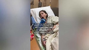 Woman Learns She Has Teratoma With Teeth and Hair