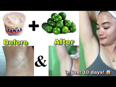 EFFECTIVE AT MURANG PAMPAPUTI NG KILI-KILI | DIY TAWAS KALAMANSI | Mhelai Magpantay 🇵🇭