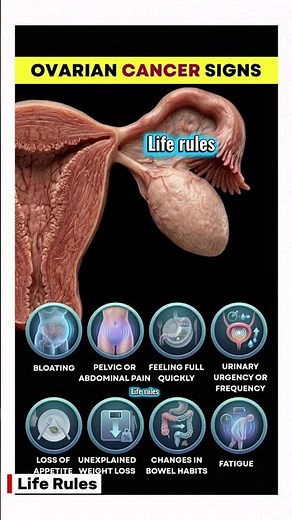 8 Early Warning Signs of Ovarian Cancer