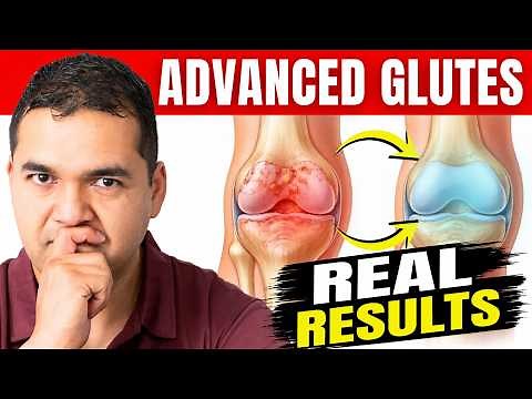 Advanced Glute Exercises to Avoid Knee Replacement (+ How to Walk Correctly)